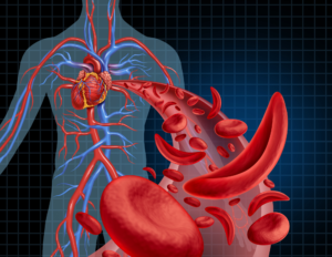 Illustration of a sickle cell and blood